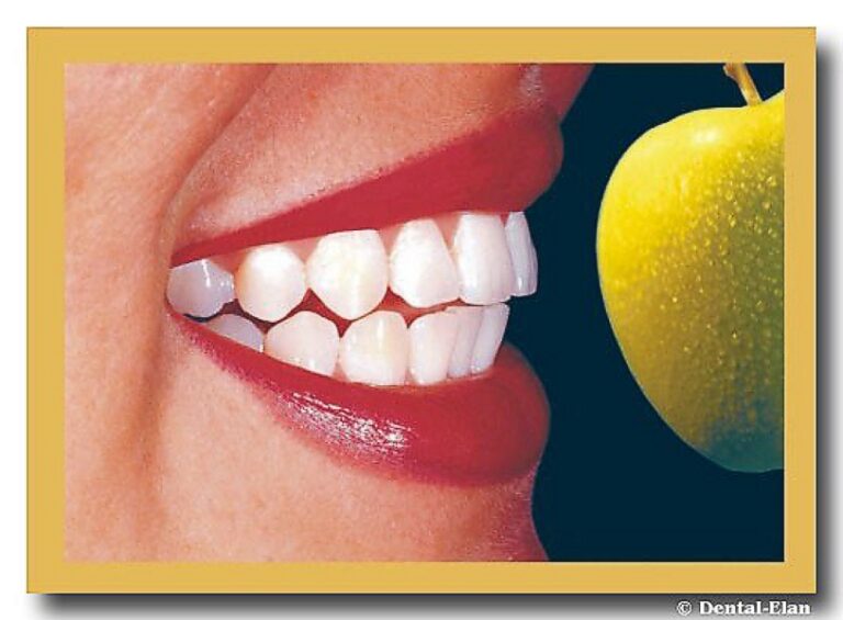 Roter Mund mit Apfel schöne Zähne von Miss Deutschland 2003 Alessandra Alores
